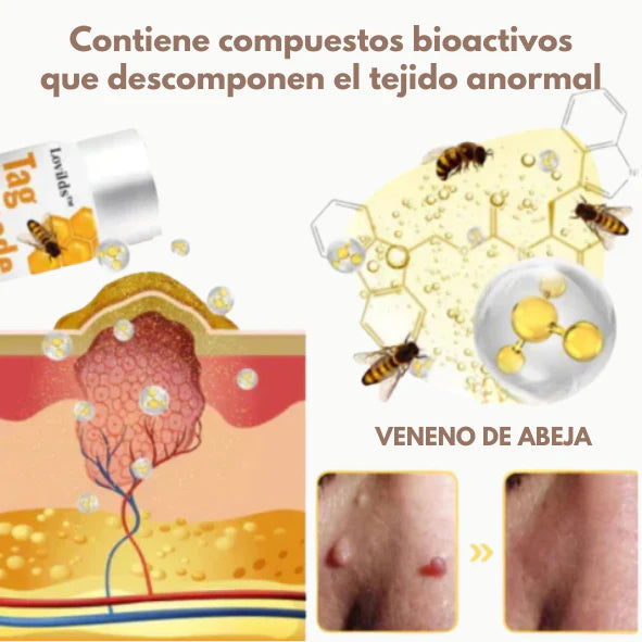 Super Oferta 2x1 TagFree Pro ¿Estás listo para decirle adiós a las verrugas?